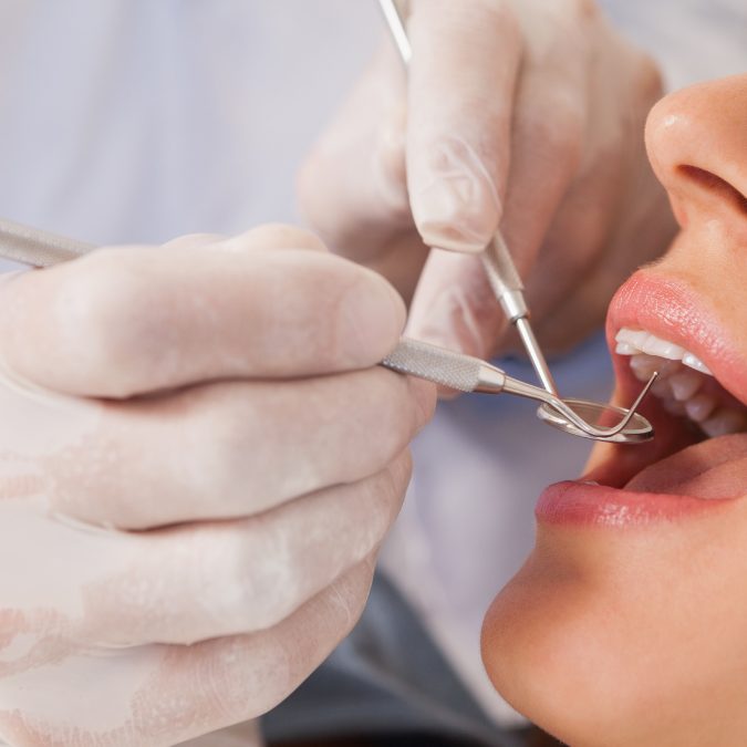dentist performing work on patients mouth 